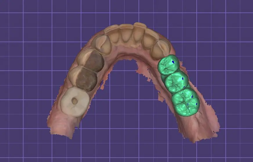 Imagine decorativă dentară